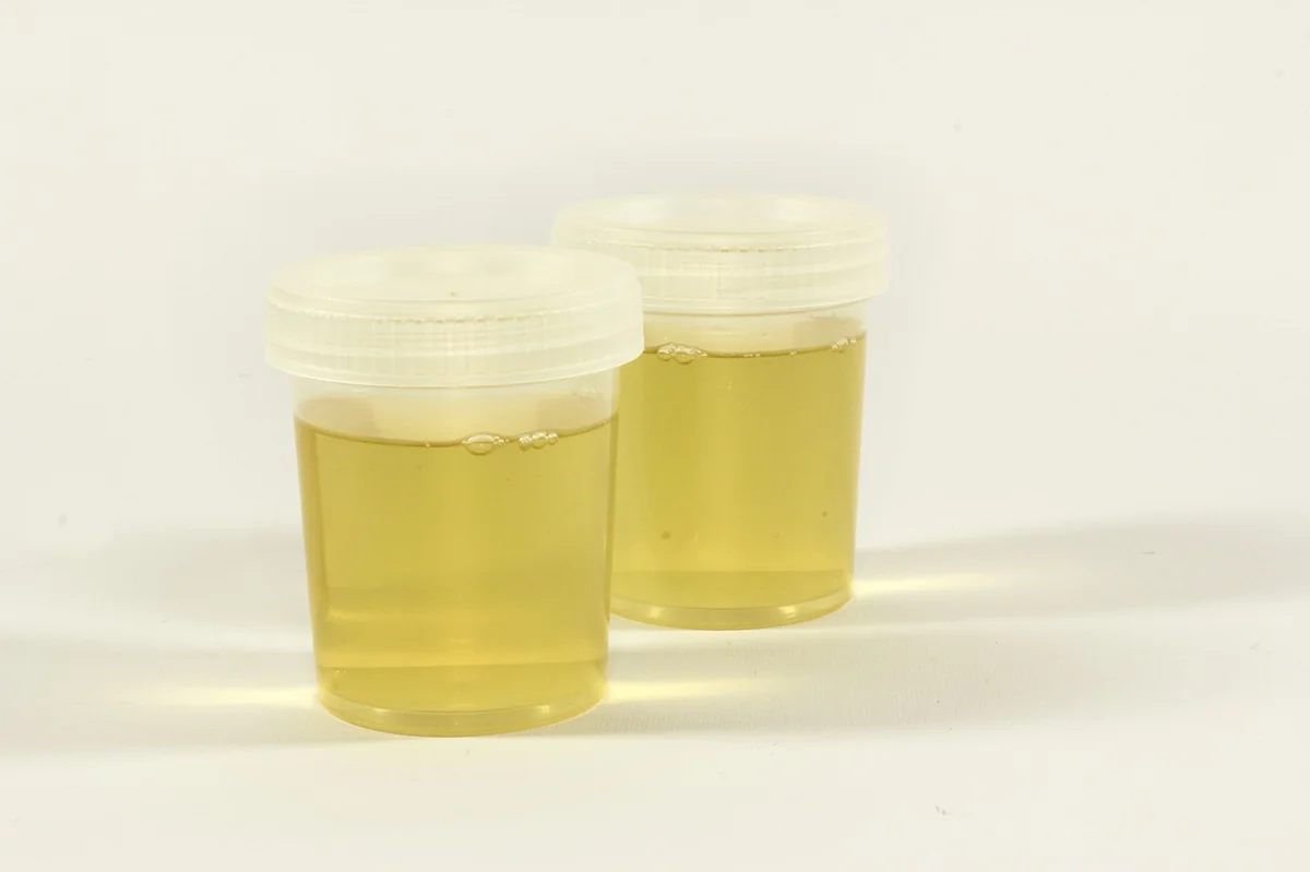 test, a container for urine, urine, inflammation, analysis, medical, lab, test tube, diagnostics, tests, the doctor, hospital, medic, download, urine, urine, urine, urine, urine - sidebyside performance test of best air purifiers for large rooms